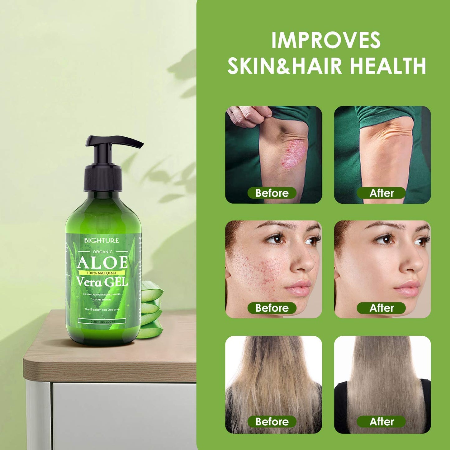 BIGHTURE 100% Aloe Vera Gel from Fresh Aloe Leaves – Soothing, Firming, After Shave & Sunburn Relief Skincare