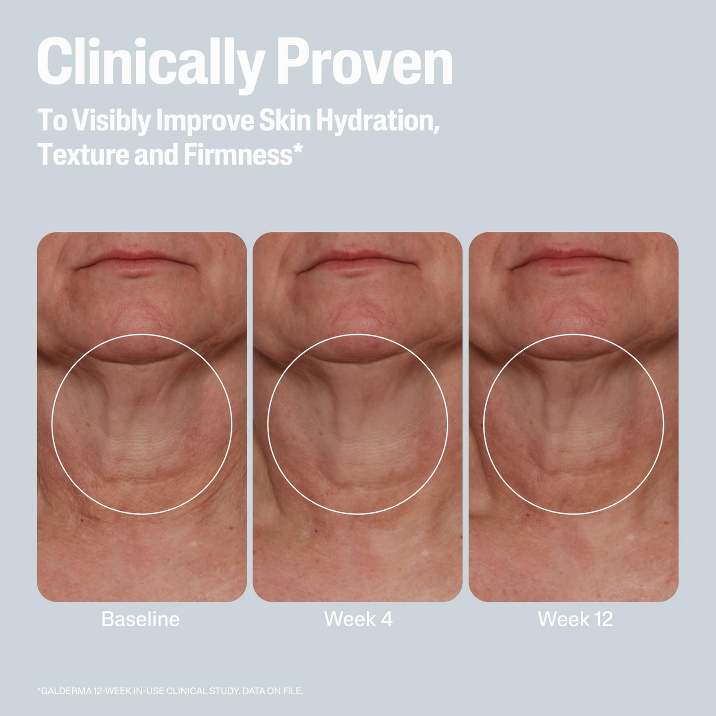 Cetaphil Skin Activator Hydrating & Firming Cream with Mandelic Acid & Centella Asiatica, 3.4 oz – Anti-Aging Face, Neck & Chest