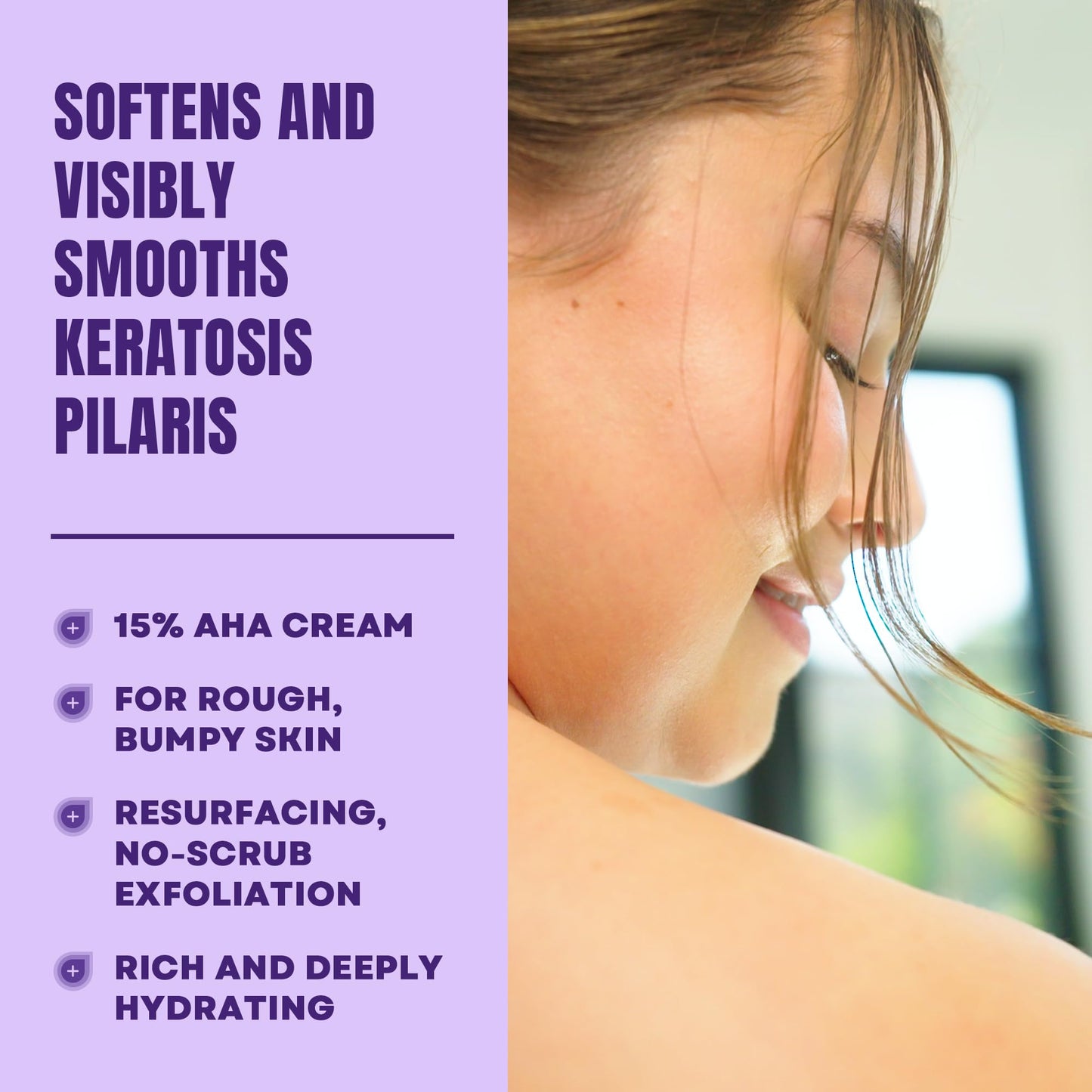 AmLactin KP Bumps Be Gone 3oz - 15% Lactic Acid Moisturizing Cream for Keratosis Pilaris, Dry, Rough & Bumpy Skin Exfoliator
