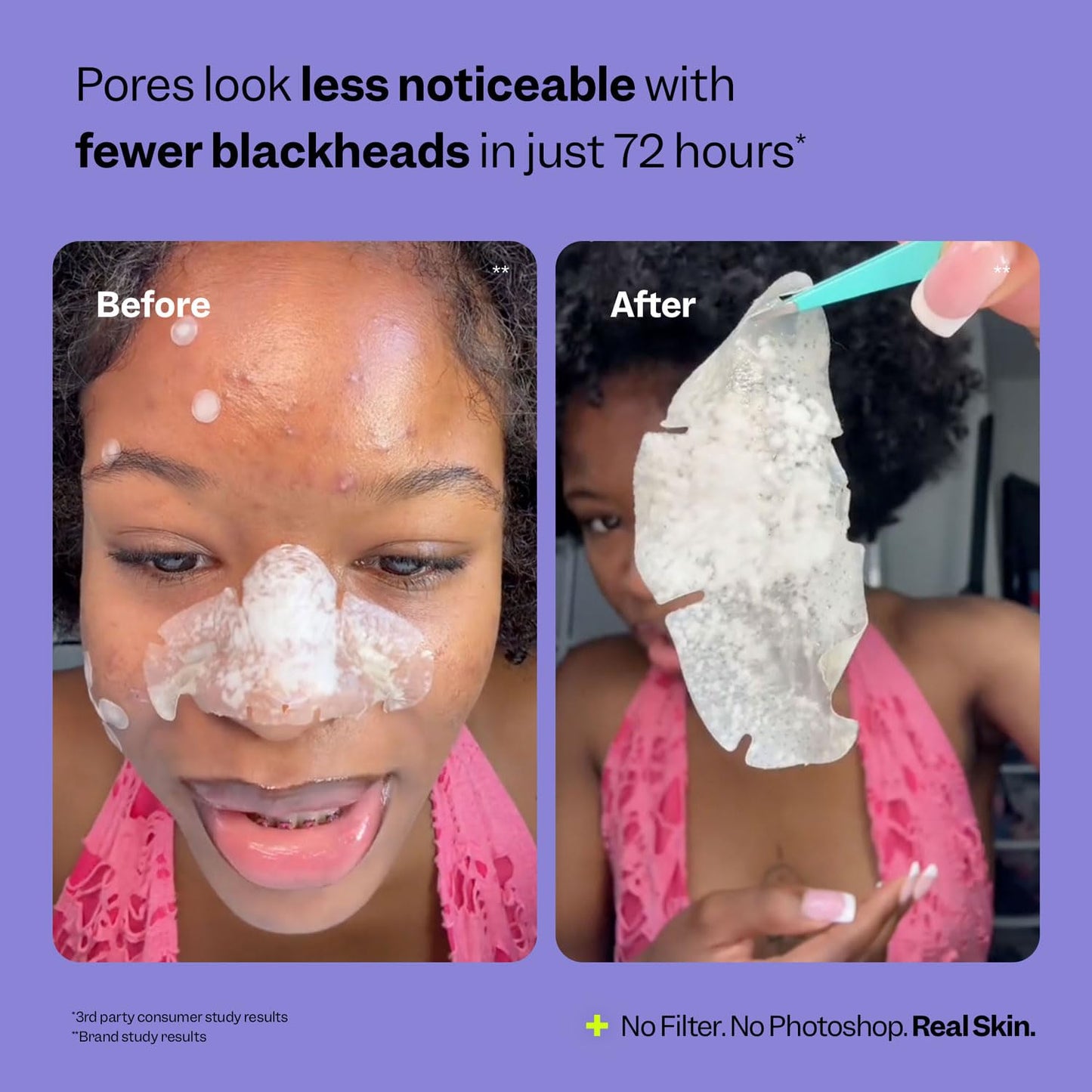 Peach Slices Nose Pore Patches – Medical-Grade Hydrocolloid, Targets Pimples & Oil, Overnight Skincare, Vegan & Cruelty-Free, 7 Ct