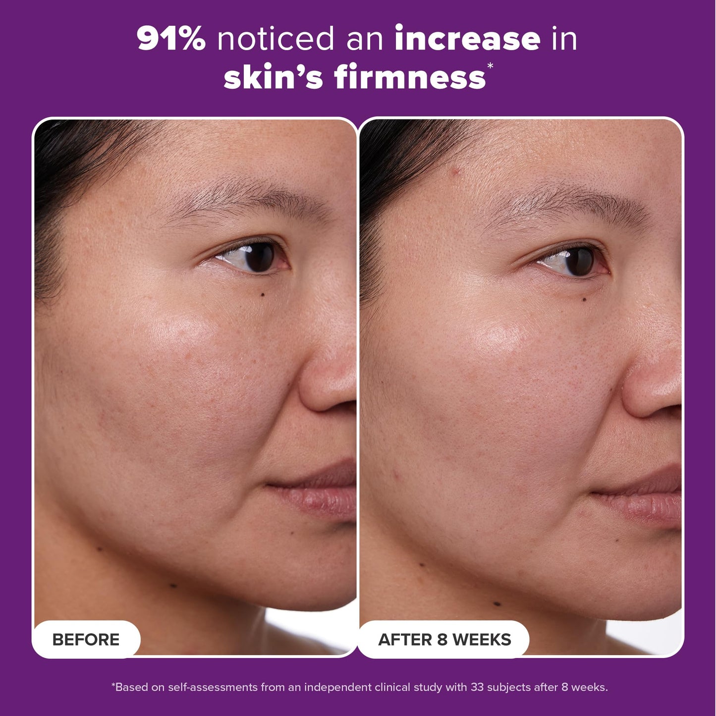 Paula's Choice Clinical 1% Retinol Face Moisturizer with Peptides, Vitamin C & Licorice, Anti-Aging Wrinkle Cream, 1 fl. oz