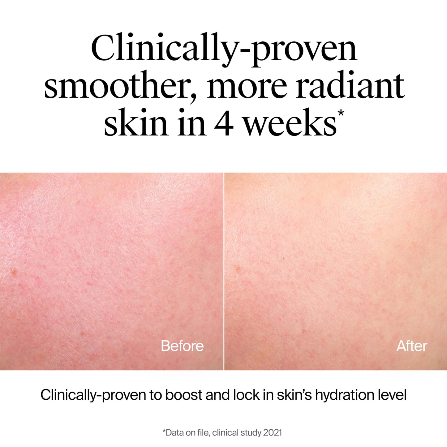 Neutrogena Hydro Boost Hydrating Face Wash, Fragrance-Free Gel Cleanser with Hyaluronic Acid, Daily Foaming Cleanser & Makeup Remover, 7.8 fl. oz