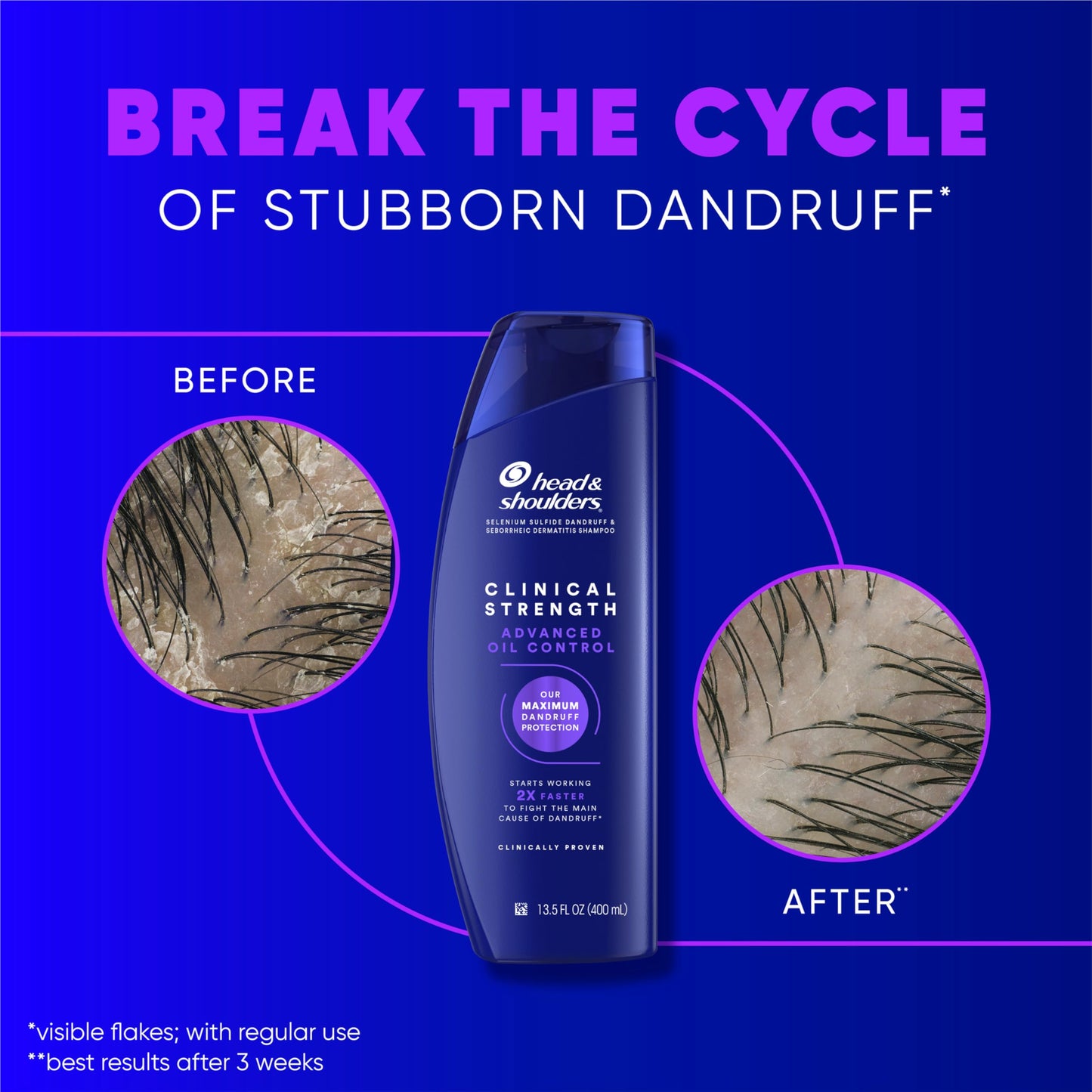 Head & Shoulders Clinical Dandruff Shampoo Twin Pack | Prescription Strength for Seborrheic Dermatitis, Oil & Flake Control, Citrus, 13.5 Fl Oz Each