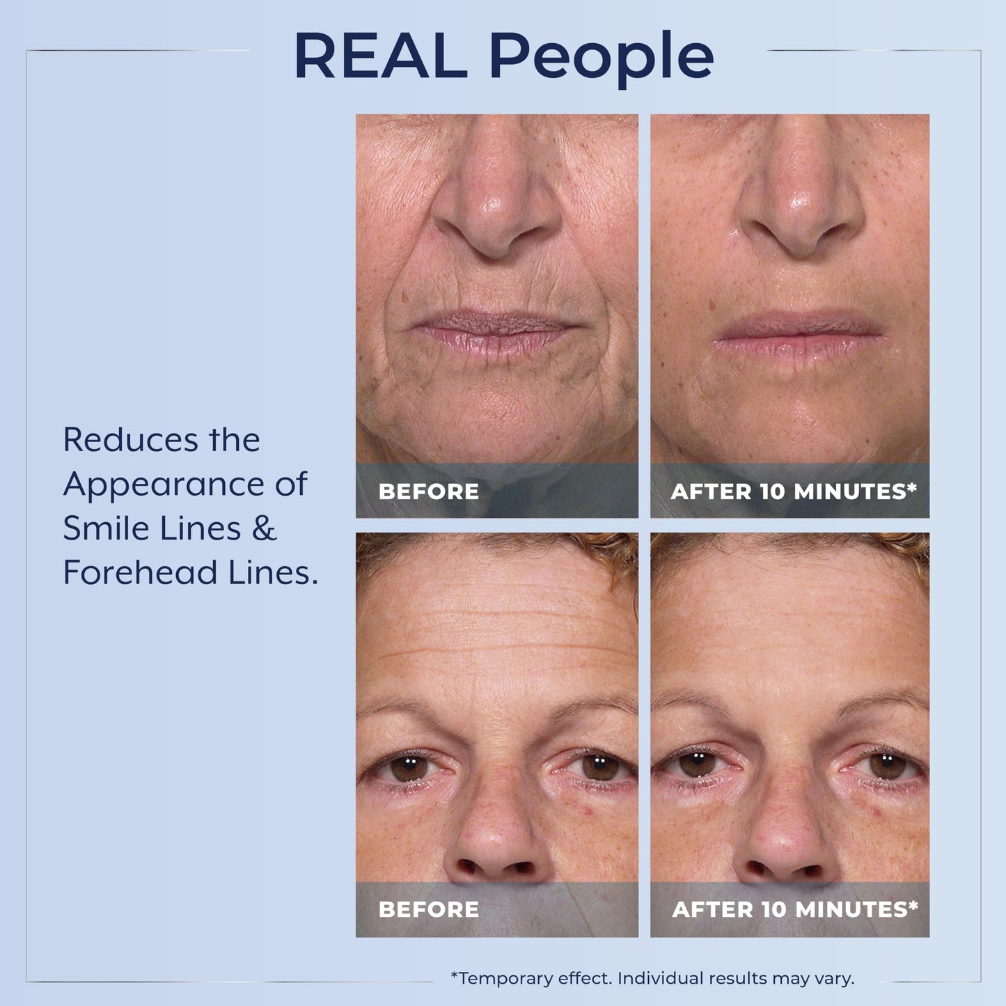 Plexaderm Rapid Reduction Eye Serum – Instantly Reduces Under-Eye Bags, Wrinkles, Dark Circles & Fine Lines, Anti-Aging Pump