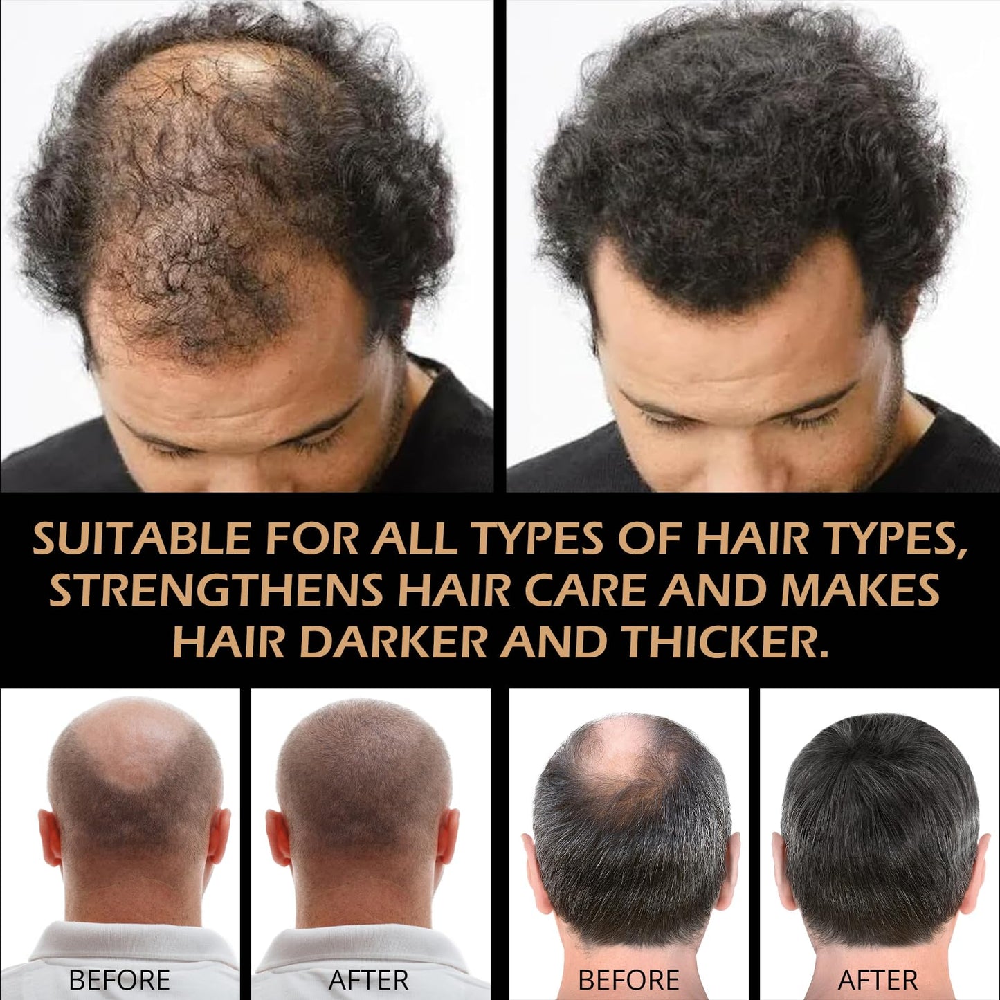 Root Activator Shampoo 2PCS – Anti Hair Loss & Shedding Treatment | Natural Regrowth Formula | Thickening, Nourishing & Smoothing for All Hair Types