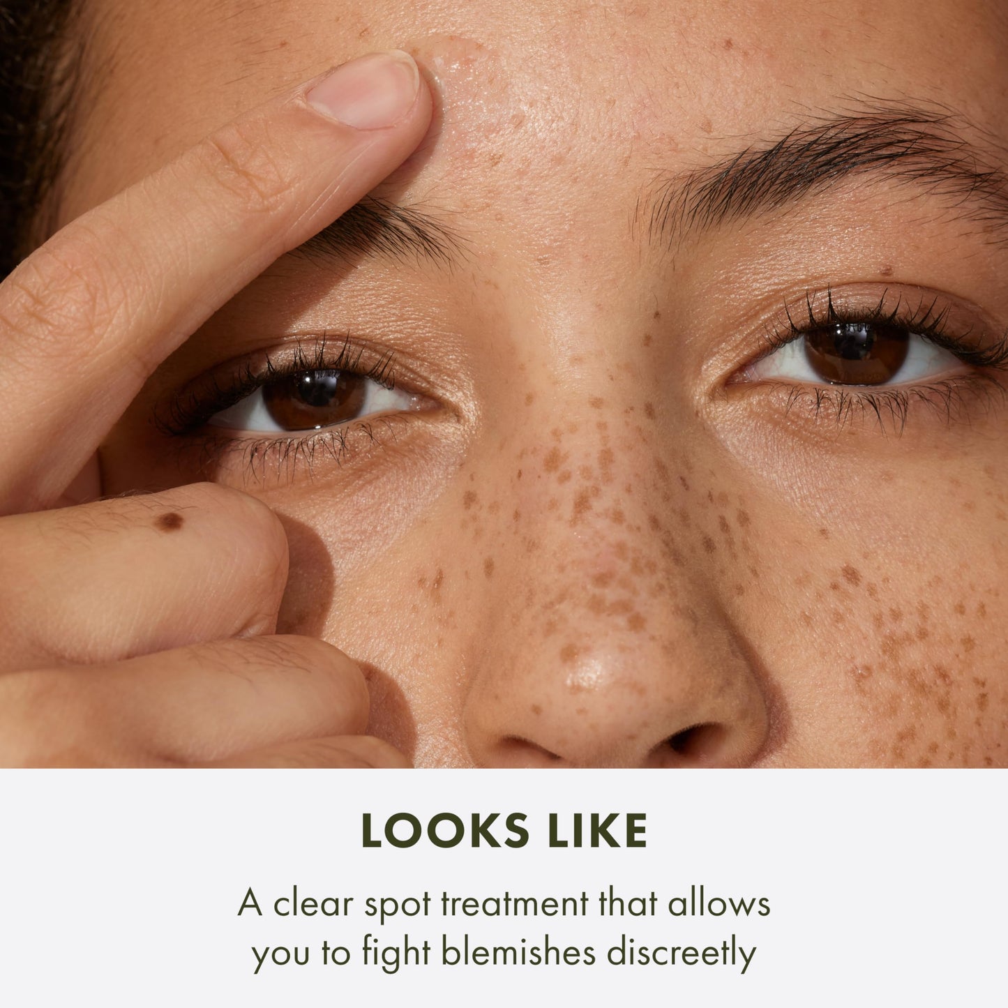 Origins Super Spot Treatment for Acne | Treats & Prevents Acne Blemishes | With Salicylic Acid, 0.3 Fl Oz