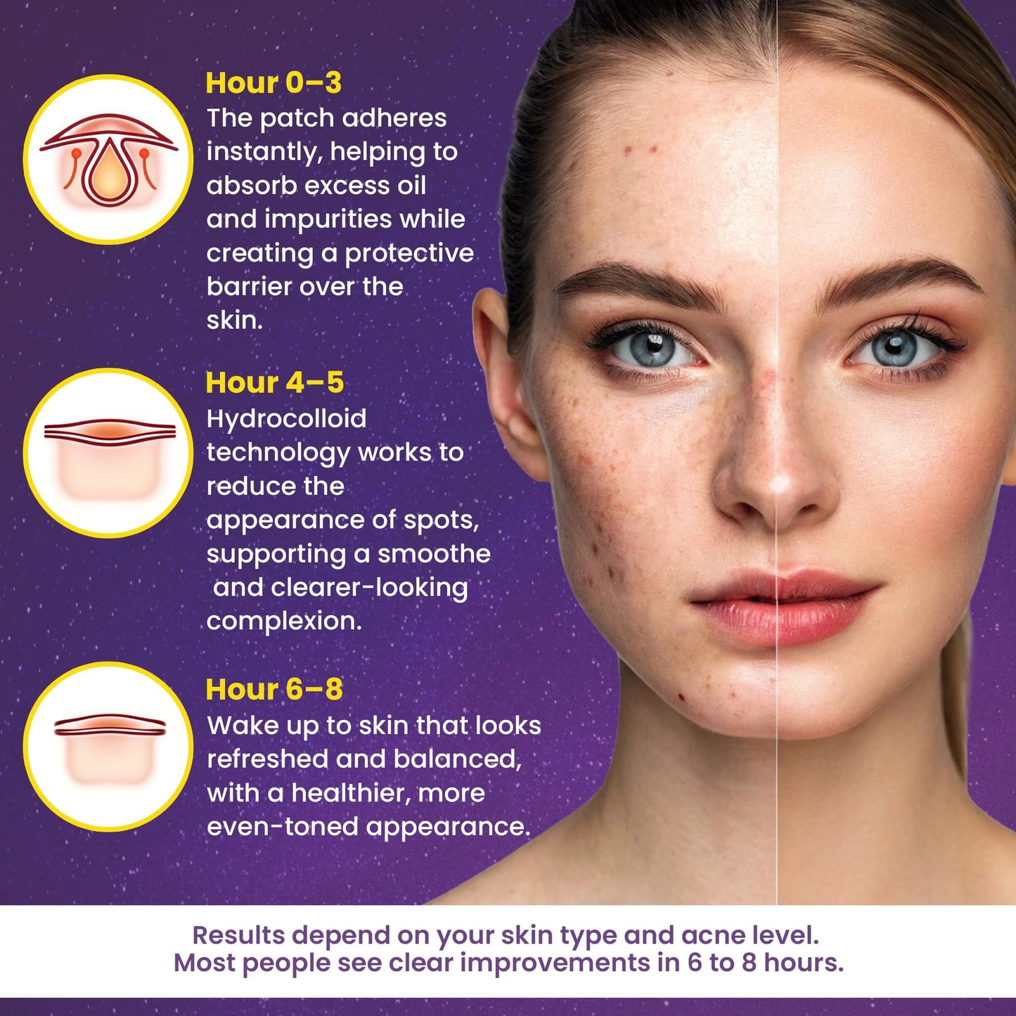 280Pcs Star Pimple Patches for Face – Hydrocolloid Acne Healing Stickers in 7 Colors & 3 Sizes – Glitter, Glow-in-the-Dark & Translucent Cute Zit Patches