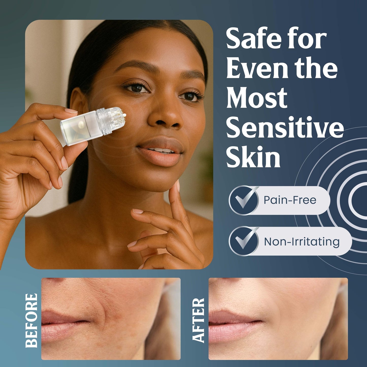 Microrevive Titanium Microneedling Kit – Home Facial System with Collagen-Boosting Derma Stamp & Hyaluronic Acid Serum, 3-Piece Set