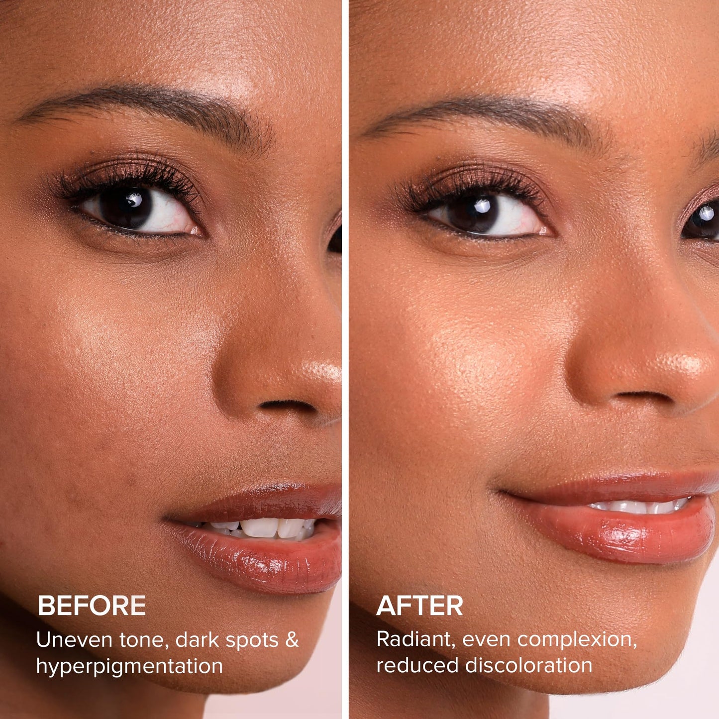 MAREE Kojic Acid & Turmeric Soap Bar – Brightening Dark Spot Remover for Face & Body, Fights Hyperpigmentation, Skin Brightener