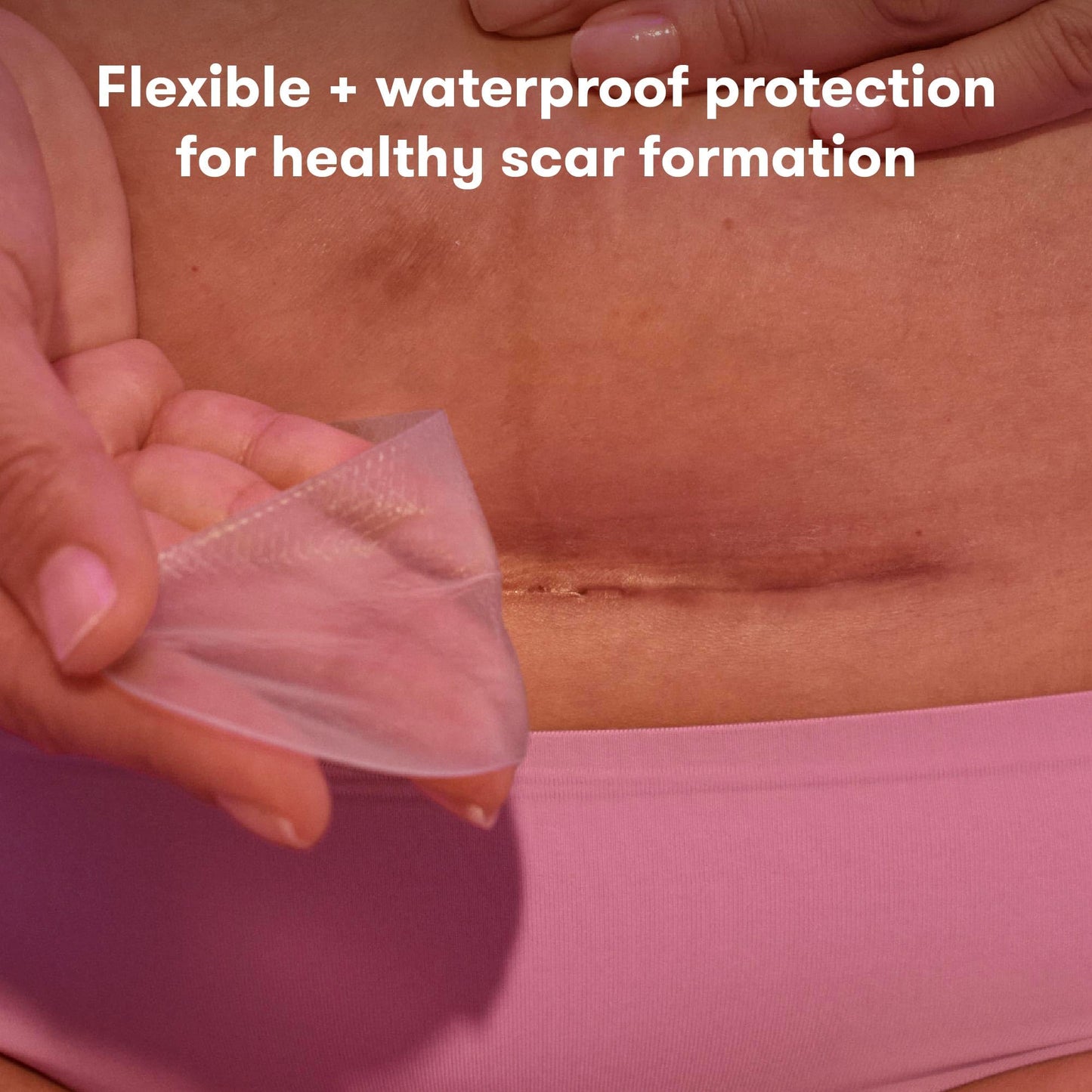 Frida Mom C-Section Silicone Scar Strips - Reusable Medical Grade Patches for C-Section Recovery, Keloid & Scar Treatment with Case & Pouch