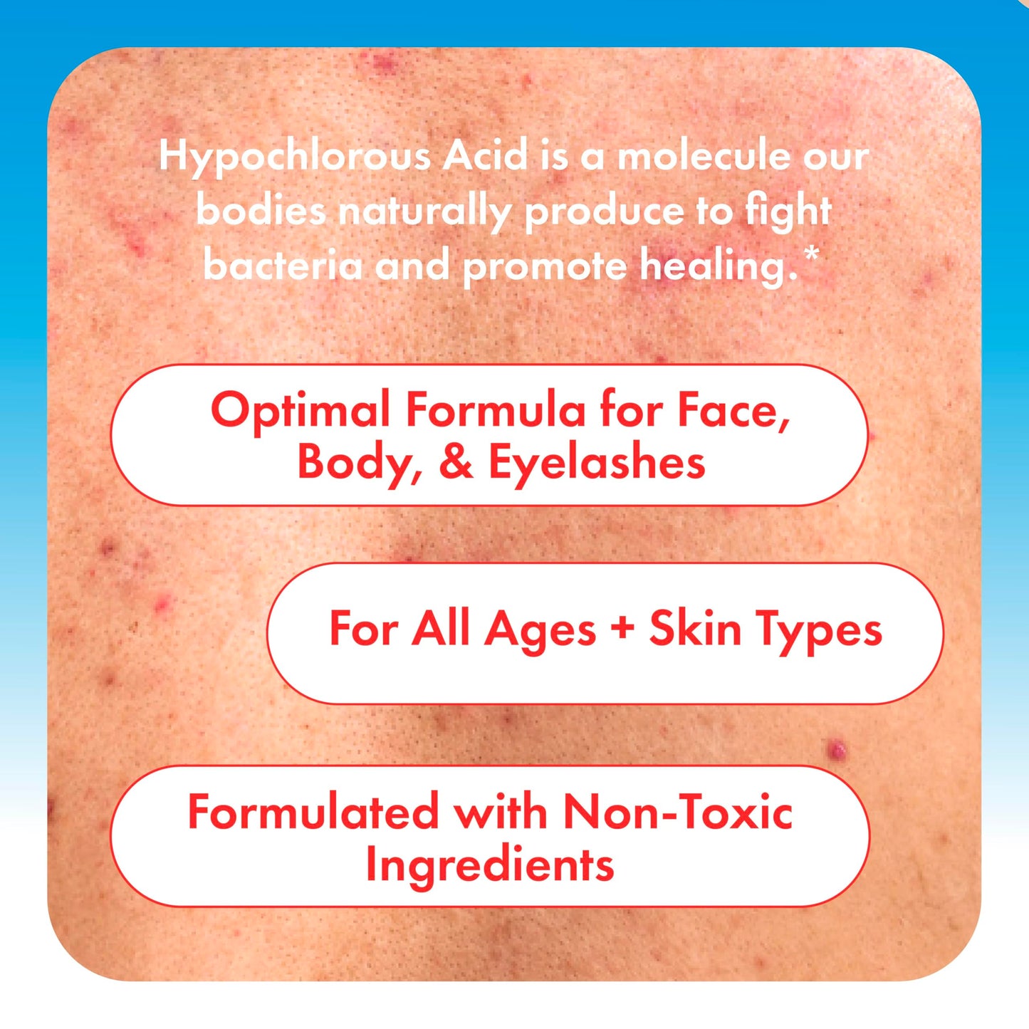 Hypochlorous Acid Spray 0.02% HOCl – Gentle Daily Cleanser for Face, Body & Eyelids, Safe for Acne-Prone, Red or Sensitive Skin, Non-Sting, 8 oz