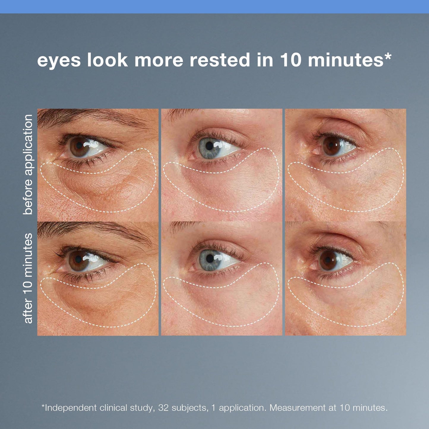 Dermalogica Awaken Peptide Eye Gel - Quickly Reduces the Appearance of Puffiness and Wrinkles