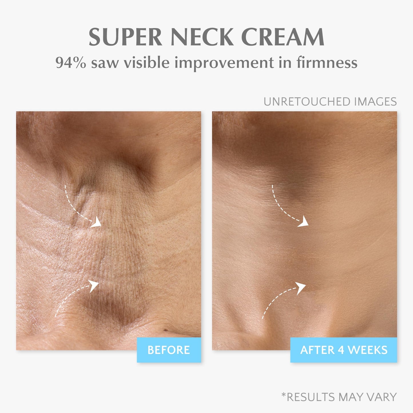 Retinol Anti-Aging Face Moisturizer for Women – Wrinkle Cream, Collagen Repair, Firming & Lifting Neck, 7% Hyaluronic Acid, 1.7 oz