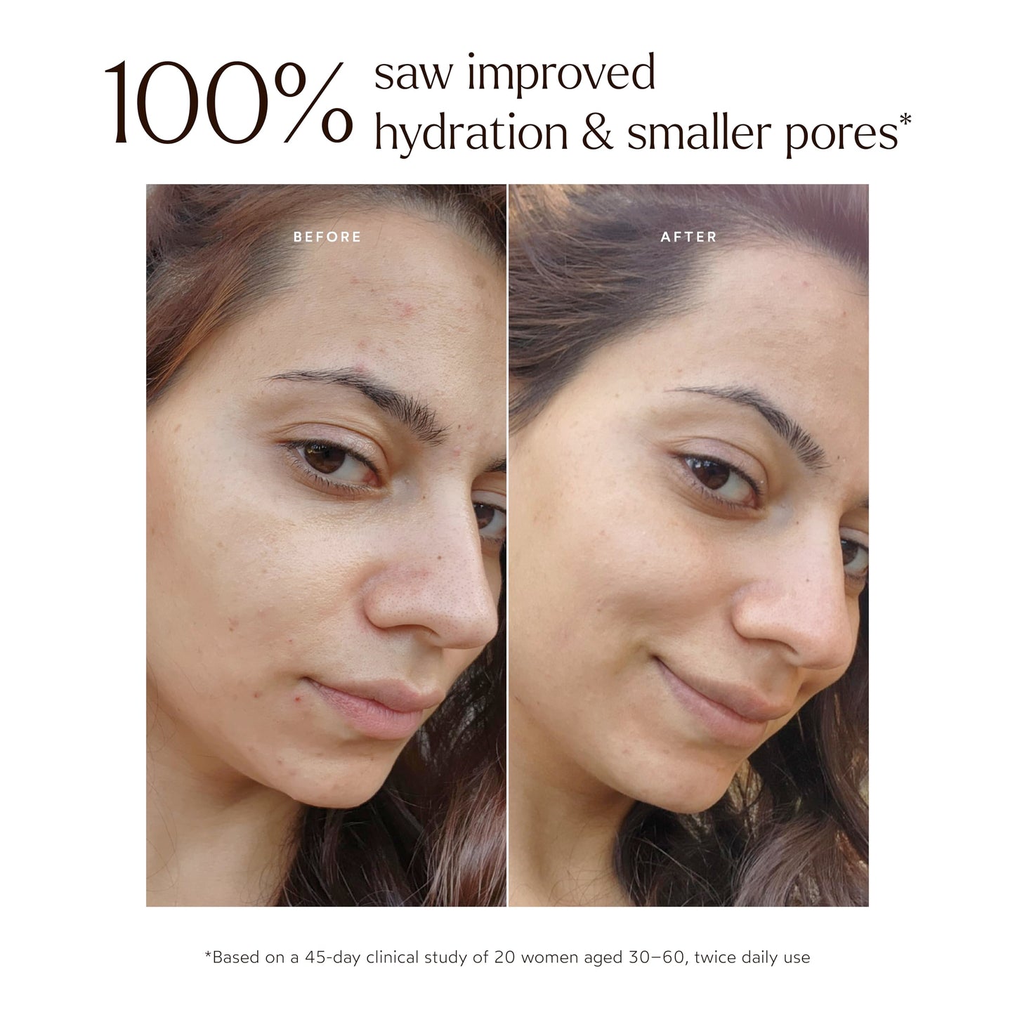 True Botanicals Renew Pure Radiance Face Oil – Anti-Aging, Fine Lines & Wrinkles, All Skin Types, Algae Extract, Vegan, 1 fl oz