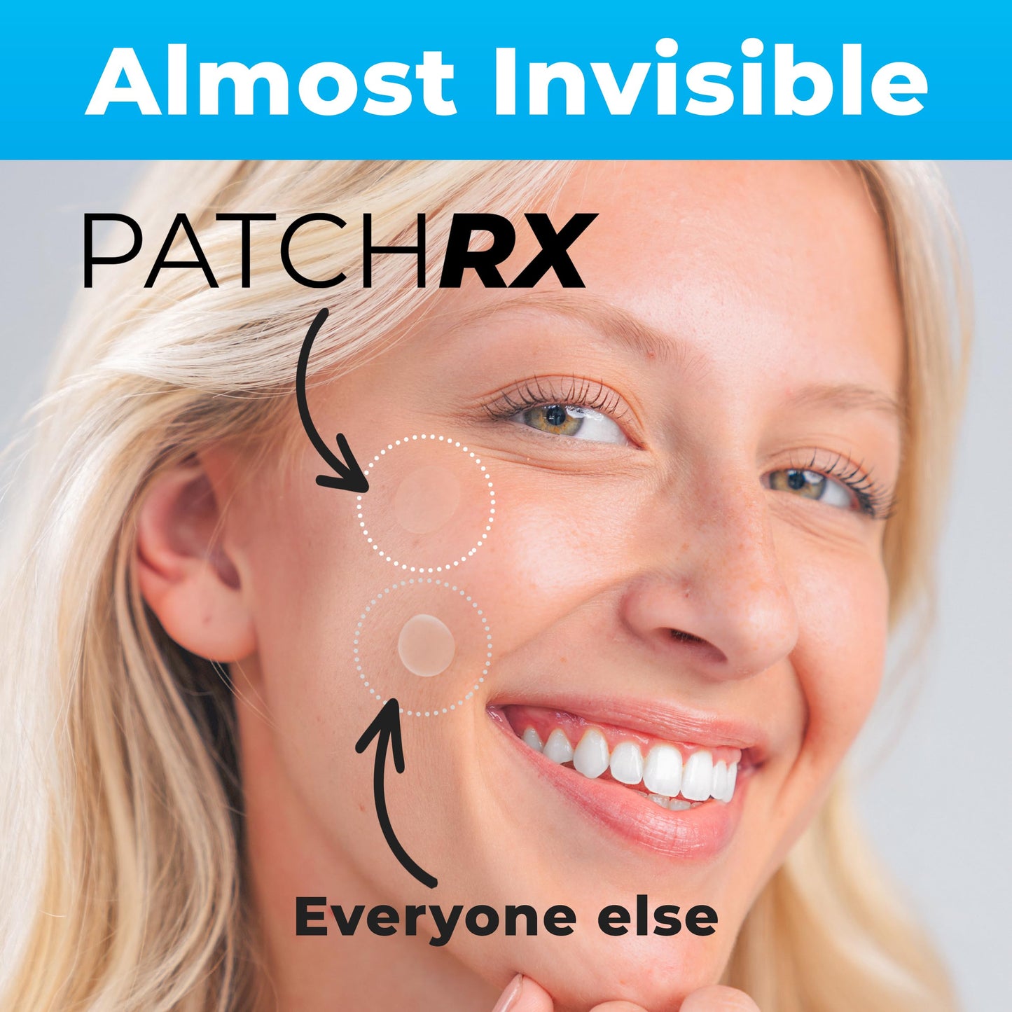 PatchRx Hydrocolloid Pimple Patches for Face (120) with Tea Tree Oil – Acne Dots & Zit Stickers for Clear Skin