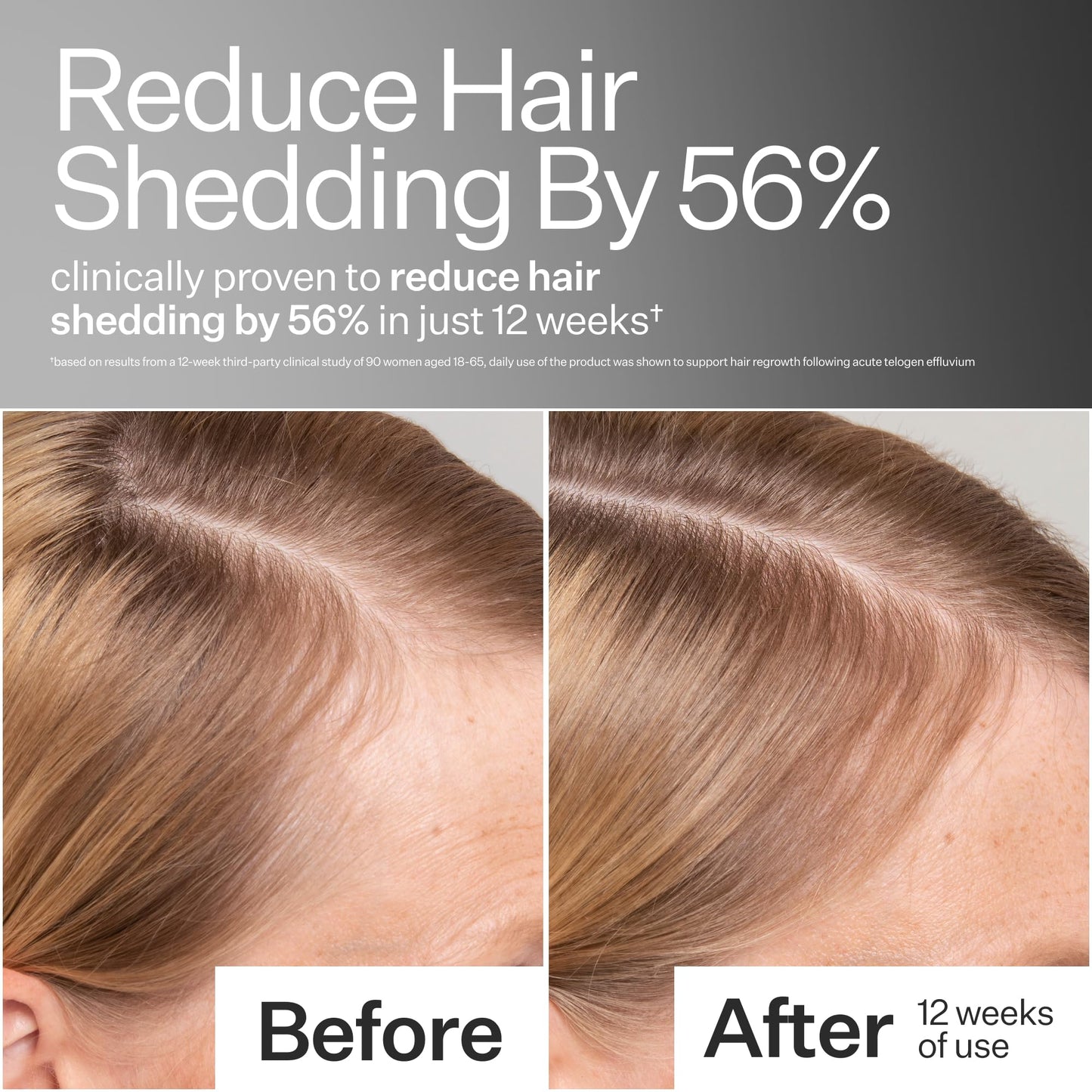 Act+Acre Stem Cell Scalp Serum – Cold Processed Formula for Thicker, Fuller Hair with Apple Stem Cells, Bamboo & Aloe – Hydrate, Strengthen, Vegan, 2.2 Fl Oz