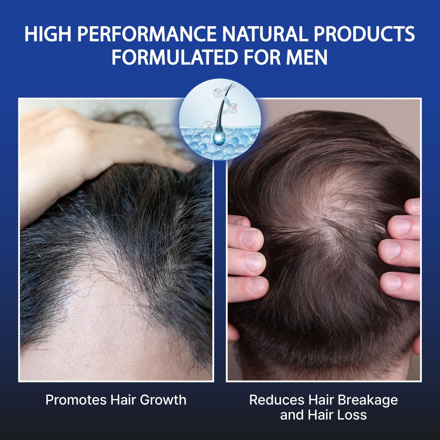 RED Pro GROOMANE Men’s Hair Conditioner with Biotin & Caffeine – Thickening, Anti-Hair-Loss, Scalp Moisturizer & Menthol Cooling, 12oz