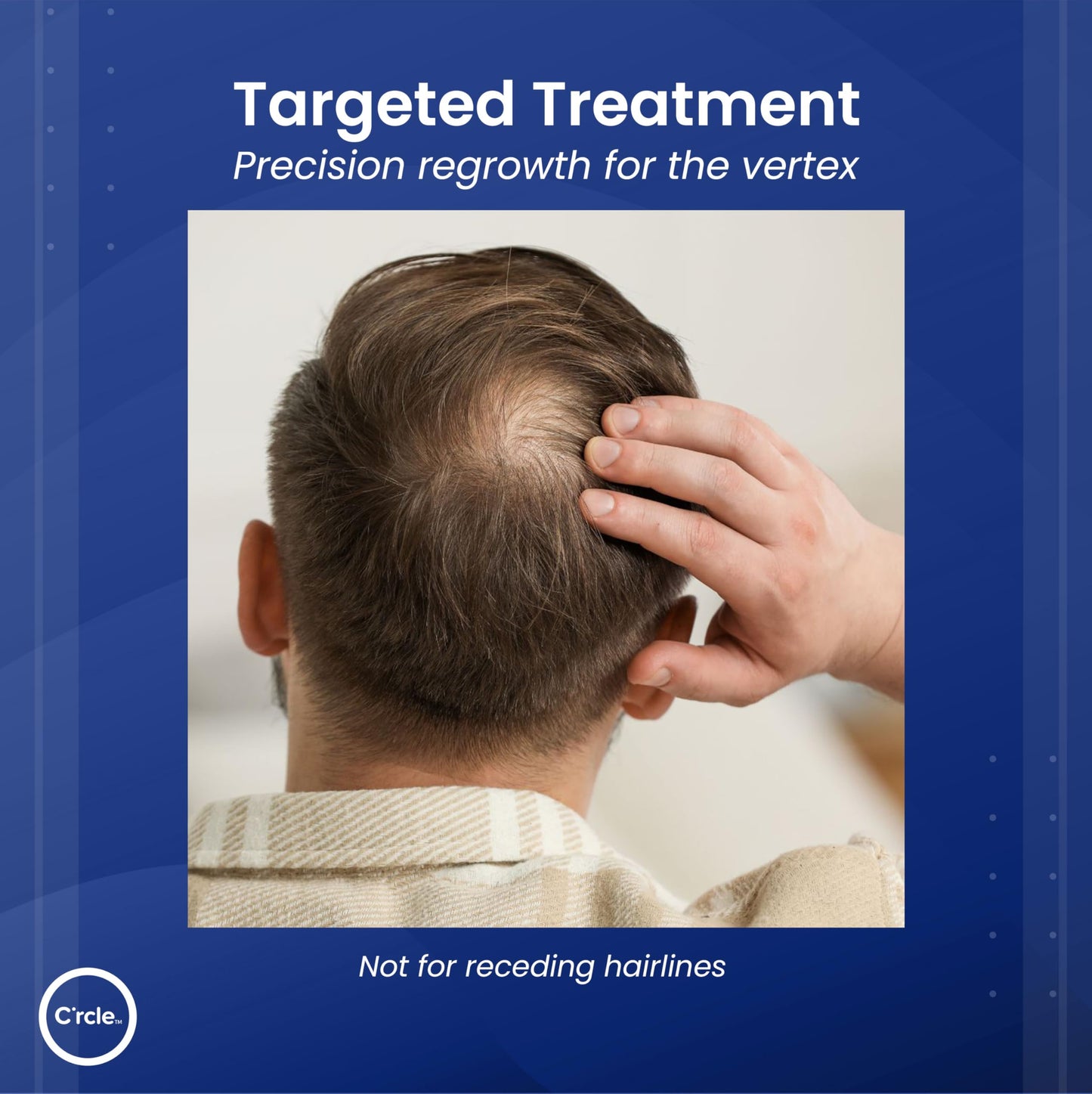 Minoxidil 5% Foam for Men – Unscented, Extra Strength Hair Regrowth Treatment – 3 Month Supply for Thinning & Vertex Hair Loss