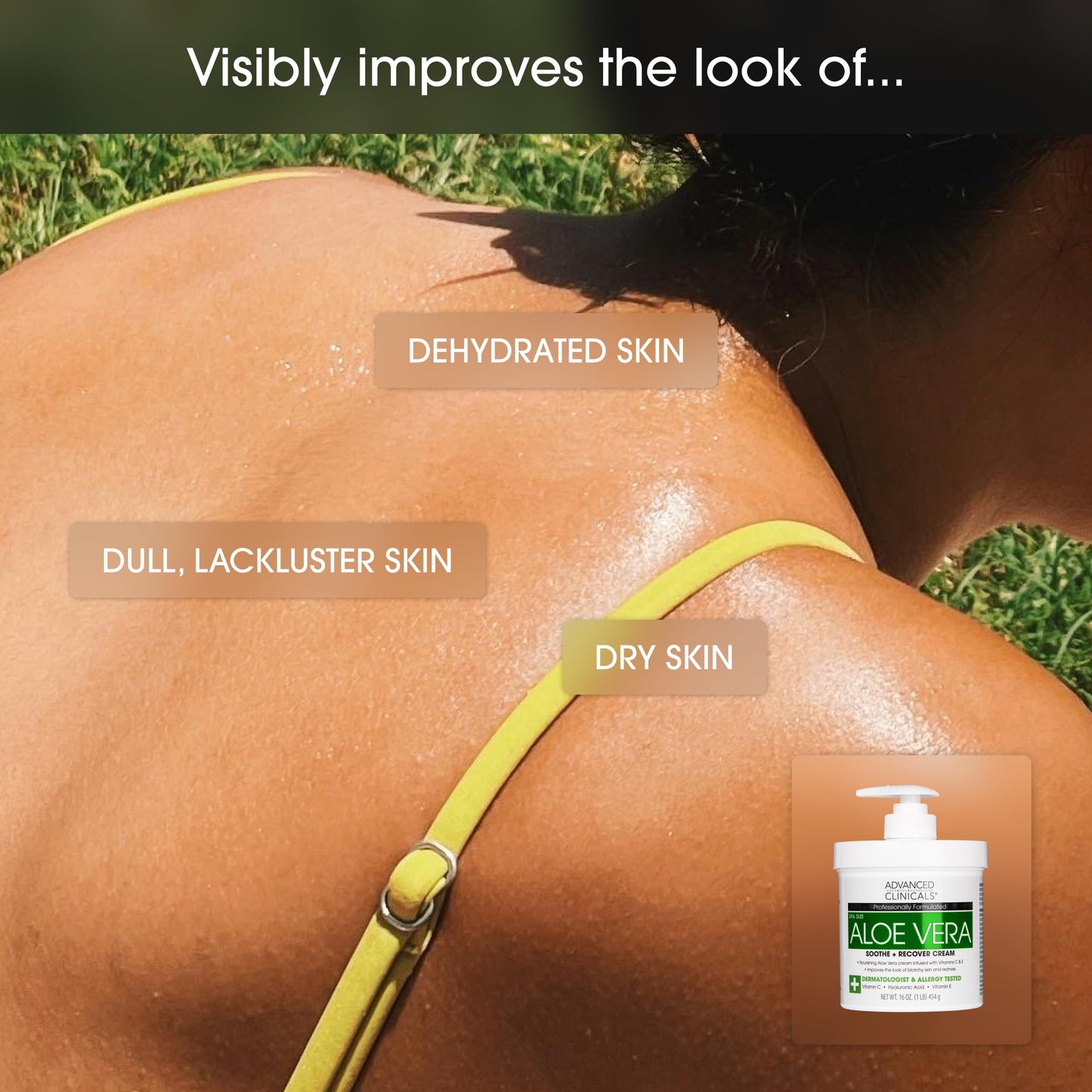 Advanced Clinicals Aloe Vera Lotion with Vitamin E & C – Hydrating Hyaluronic Acid Body Cream for Women & Men, Soothes & Restores Dry Skin, 16 oz