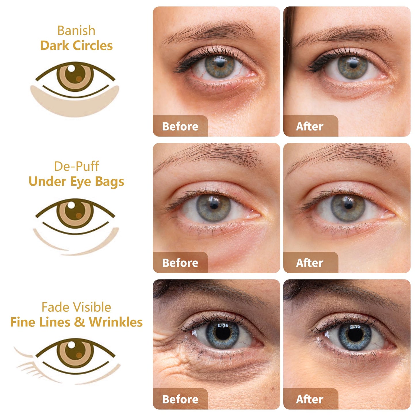 Under Eye Patches 30 Pairs – 24K Gold, Hyaluronic Acid & Rose Eye Mask for Dark Circles, Puffy Eyes, Wrinkles, Under Eye Care Gift