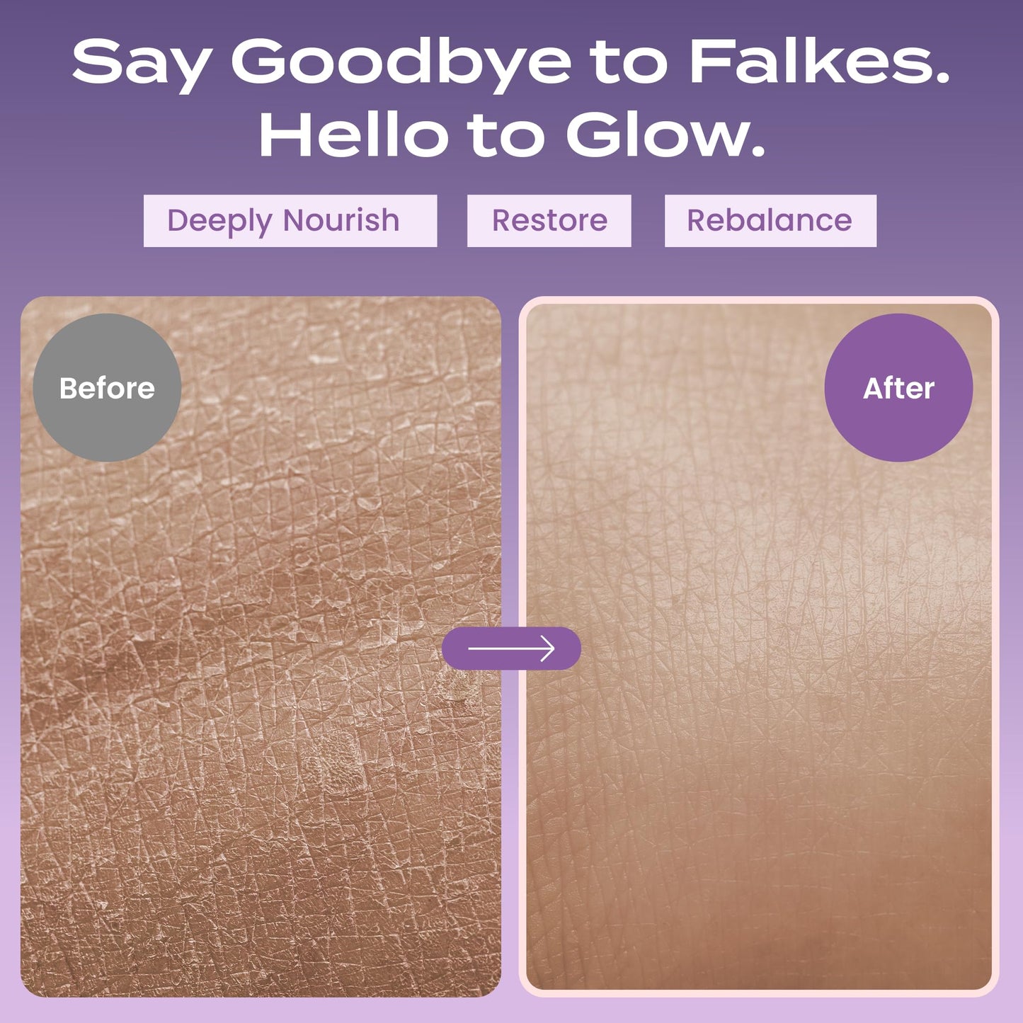 Body Restore Grass-Fed Whipped Beef Tallow for Dry Skin – Lavender, Manuka Honey & Jojoba Oil, Travel & Gift Essentials for Men & Women