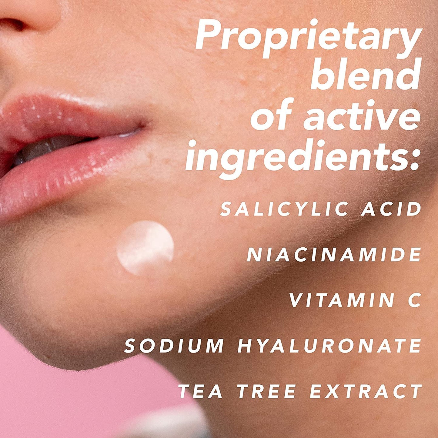 Mario Badescu AM/PM Blemish Kit – Salicylic Acid & Sulfur Drying Lotion + 12 Invisible Pimple Patch Stickers, 1 fl oz