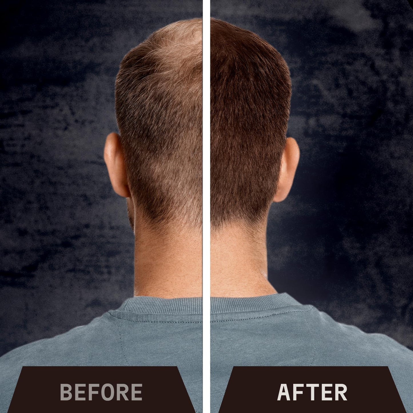 Striking Viking Hair Building Fibers for Thinning Hair - Dark Brown, 0.98 oz – Long-Lasting, Natural Hair Filler Powder for Men & Women