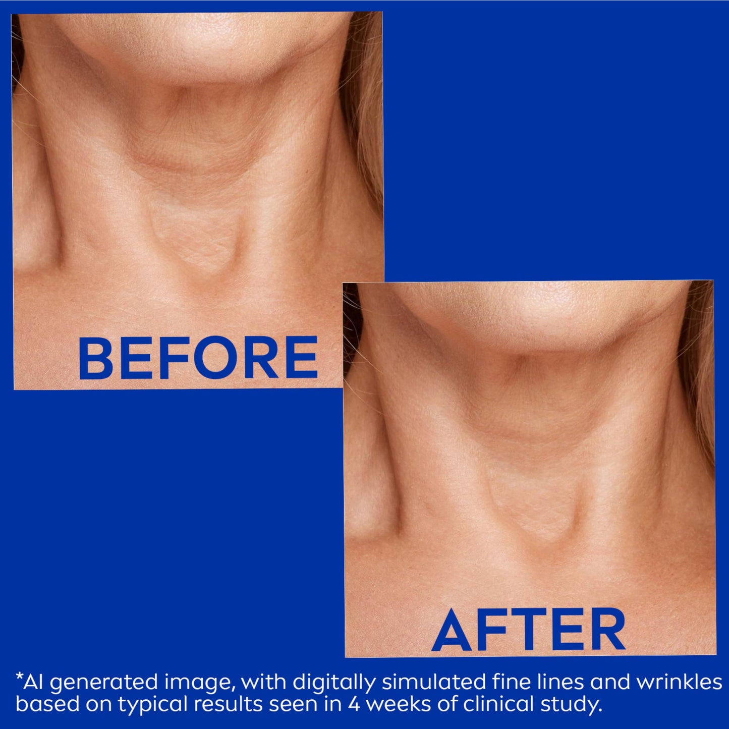 Nivea Skin Firming & Anti-Wrinkle Neck & Chest Cream with Q10, Creatine & Provitamin B5 – Reduces Fine Lines, 6.7 oz