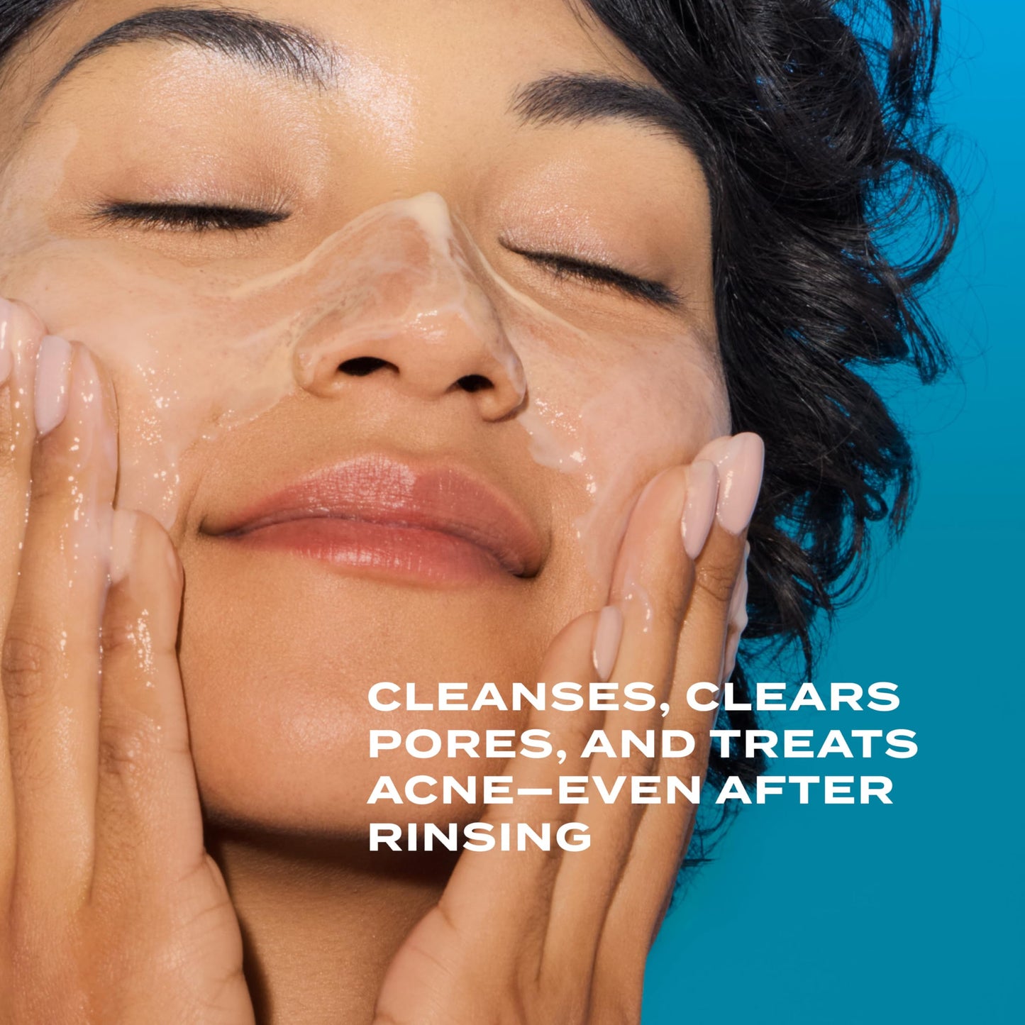 Murad Clarifying Cleanser – Salicylic Acid & Green Tea for Acne, Deep Clean, Oil Control & Breakout Prevention, 5 fl. oz