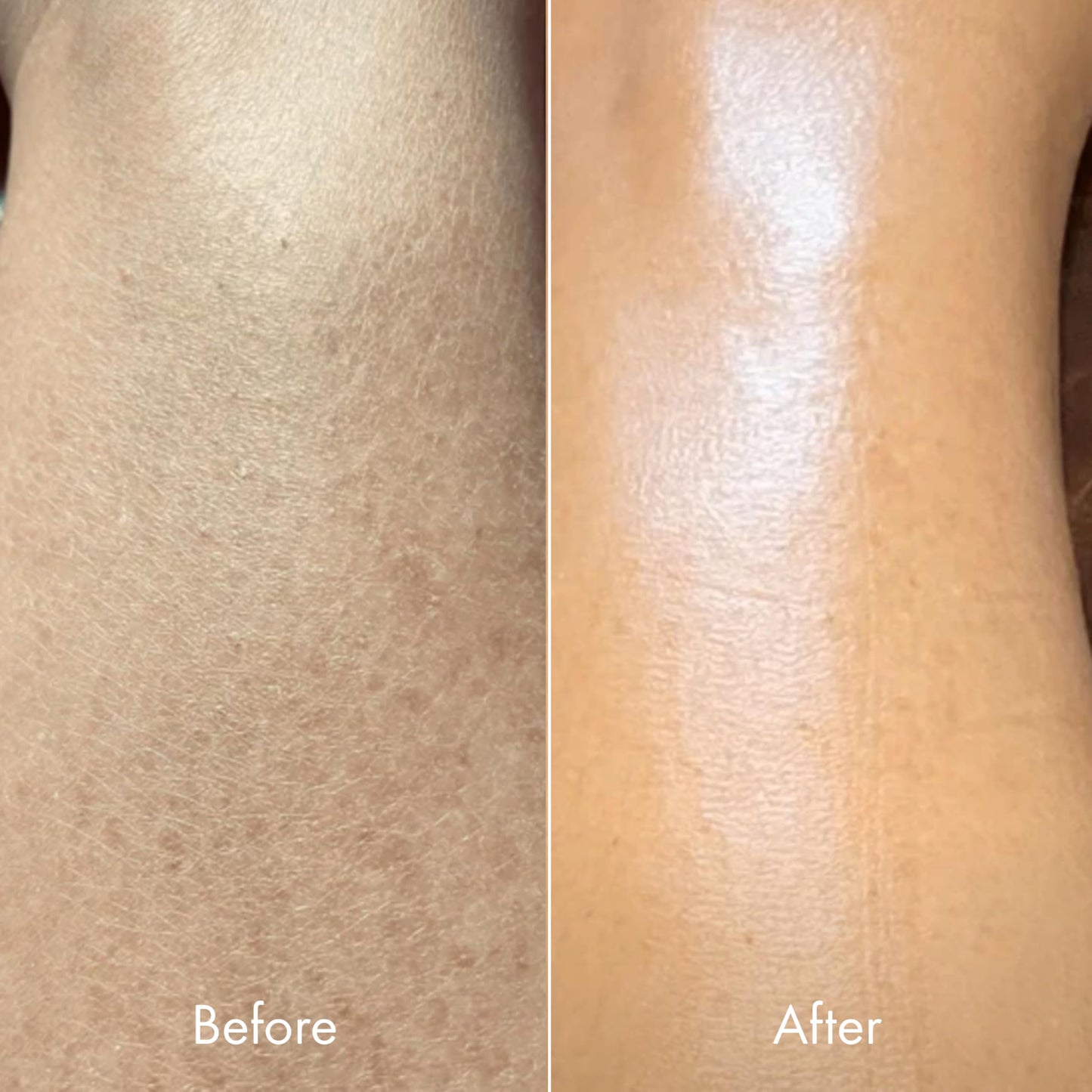 Kopari Ultra Restore Body Butter, Whipped Lightweight Formula, Hyaluronic Acid & Mango Seed Butter, Deep & Long-Lasting Moisture, Coconut 7.7 oz