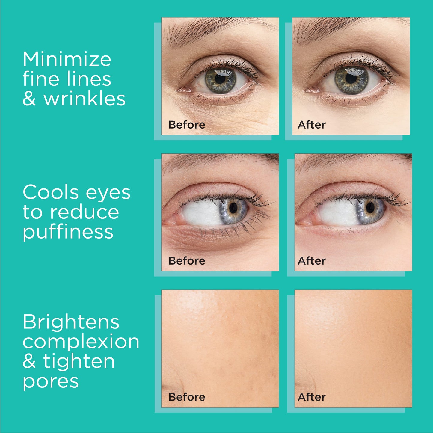 MonétBeauty Gold Stainless Steel Ice Globes – Face & Cryo Massager for Puffiness, Pore Tightening, Sinus Relief & Daily Facial Care