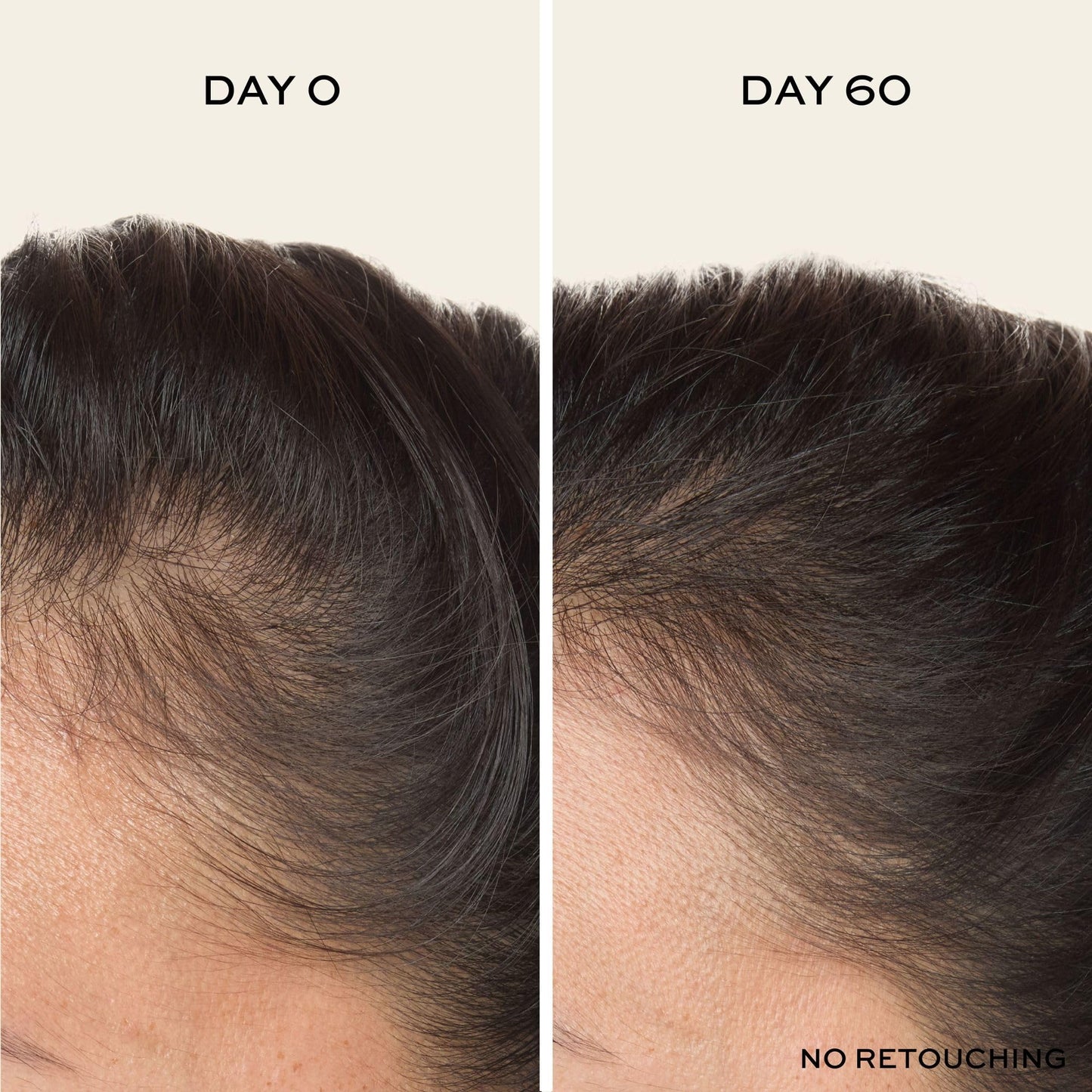 John Frieda ULTRAfiller+ Hair Density Scalp Serum for Fine Hair, Volumizing Hair Serum, Scalp Treatment for Thickening for Women and Men, 2 Oz