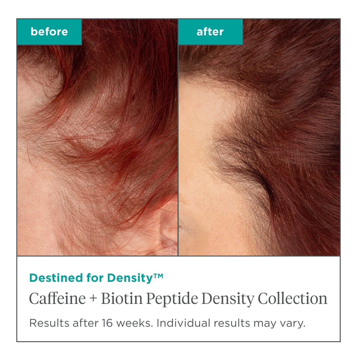 Briogeo Destined for Density Caffeine + Biotin Peptide Shampoo 8 fl oz | Boosts Thickness & Volume for Fine or Thinning Hair | Vegan & Cruelty-Free