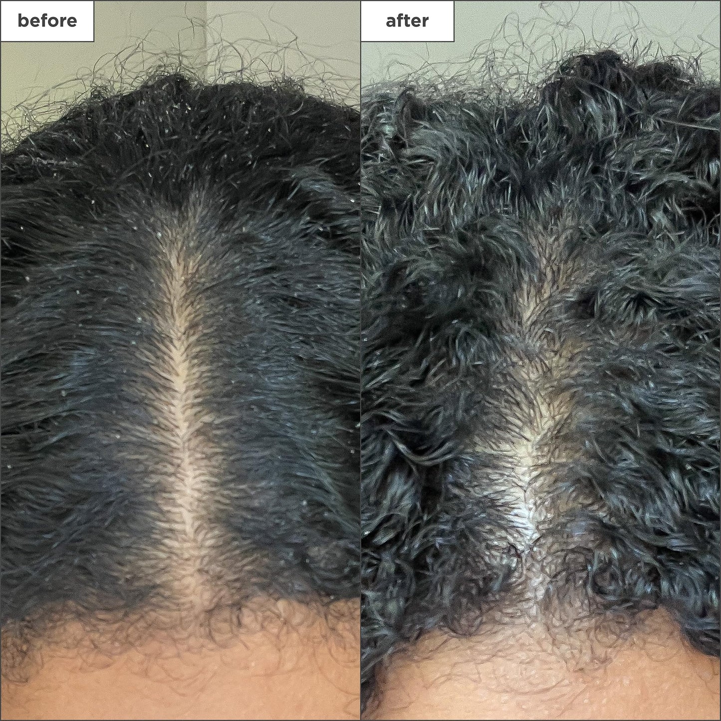 Briogeo Scalp Revival Charcoal + Coconut Oil Exfoliating Shampoo – Clarifies Build-Up, Soothes Dry Itchy Scalp, Vegan & Cruelty-Free, 2 fl oz