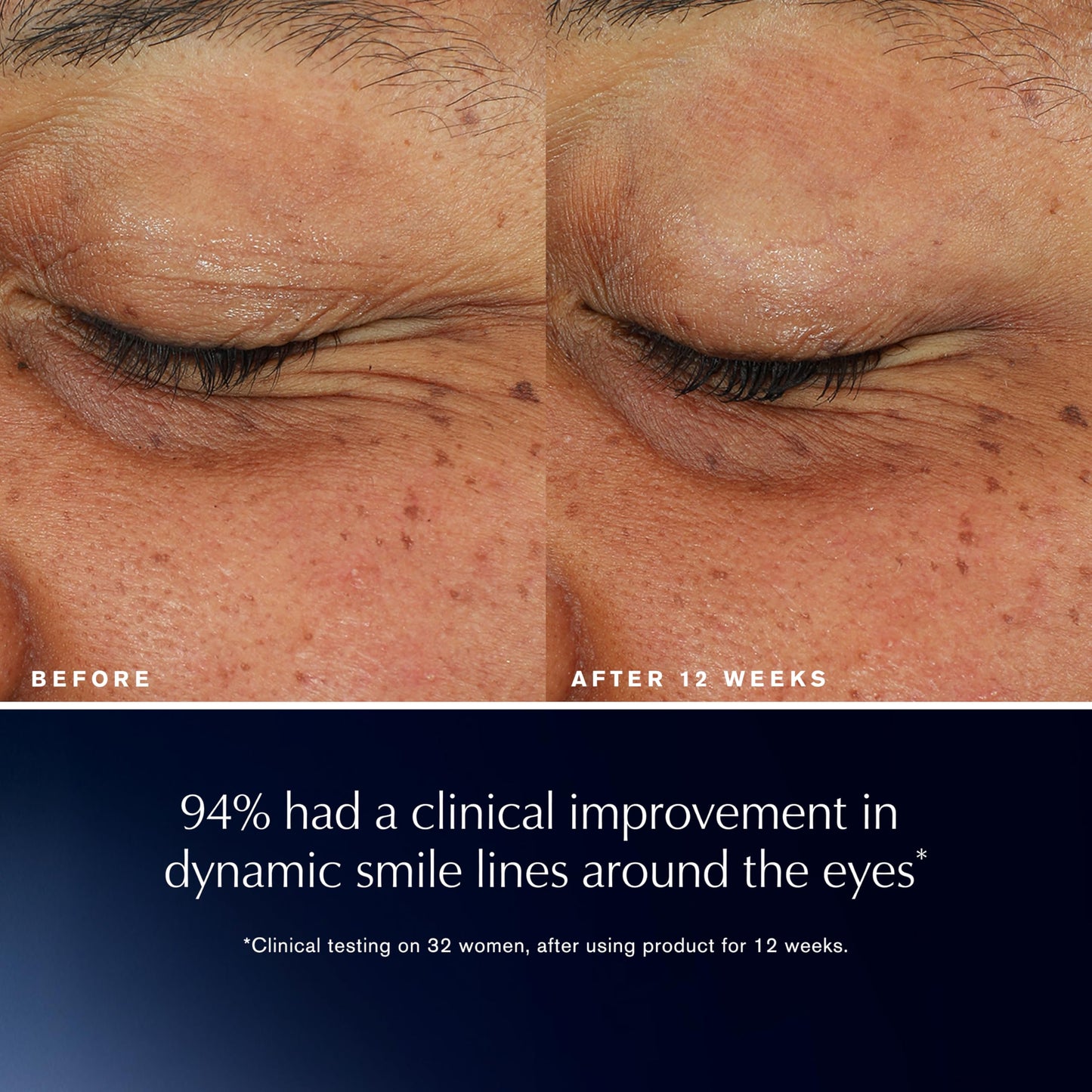 Estée Lauder Advanced Night Repair Eye Lift + Sculpt | Eye Cream with 2HA Volume Filler & Hexapeptide-8, 0.5 Fl Oz